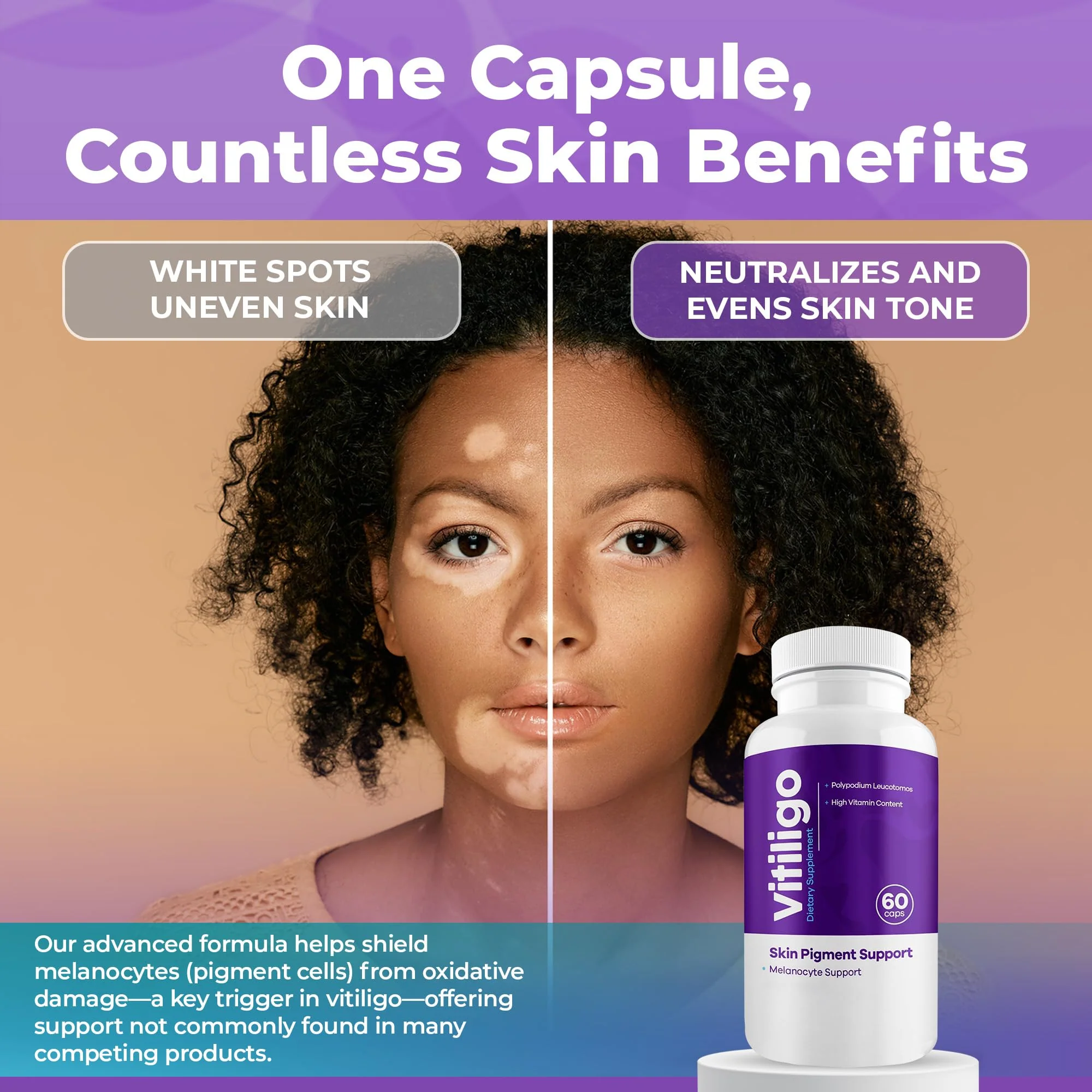 Aura Vitamins Vitiligo Capsules 60 Count | Support Skin Pigmentation & Reduce White Spots - Image 6