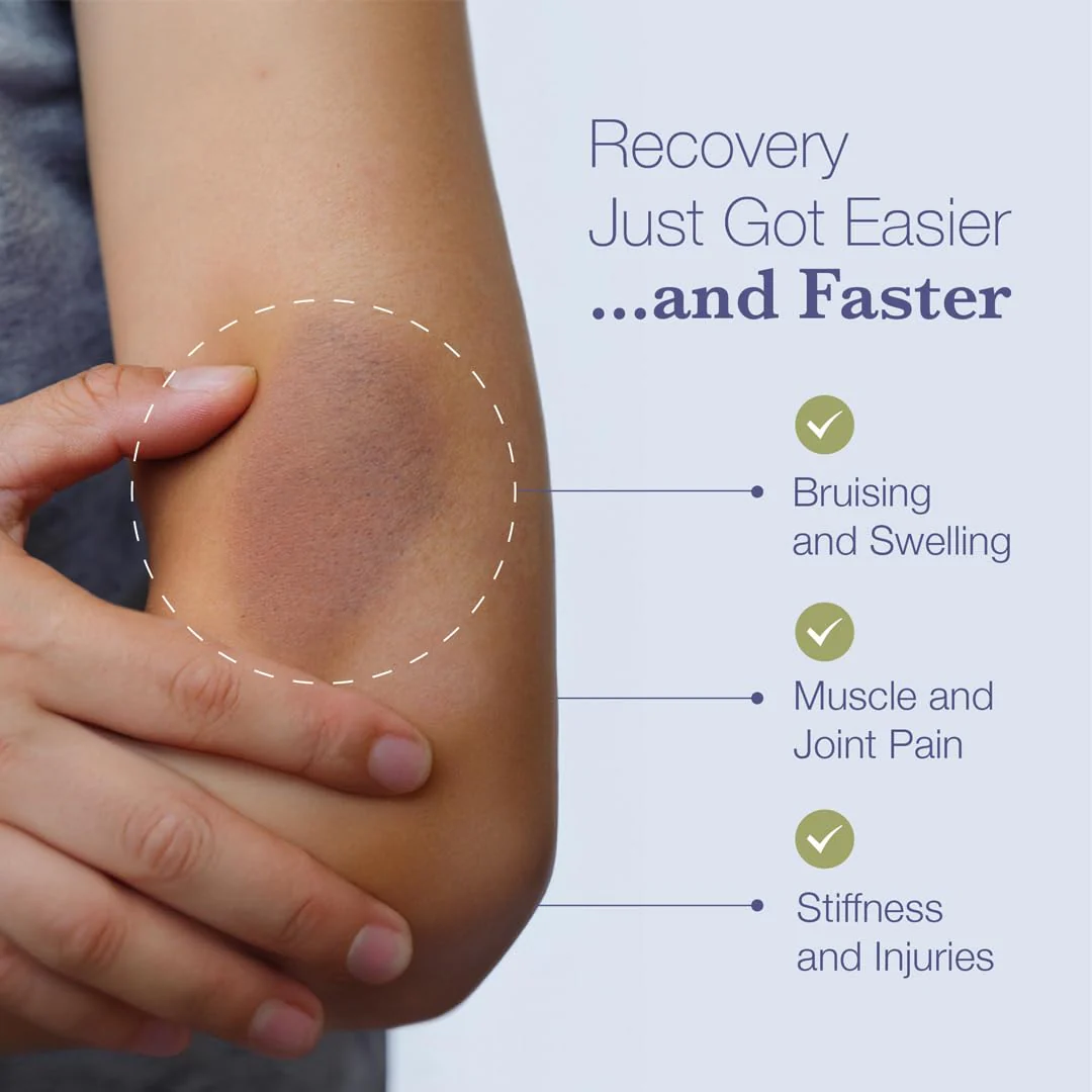 BruiseMD Arnica 1000mg & Bromelain 500mg — 14-Day Bruising and Swelling Support - Image 2