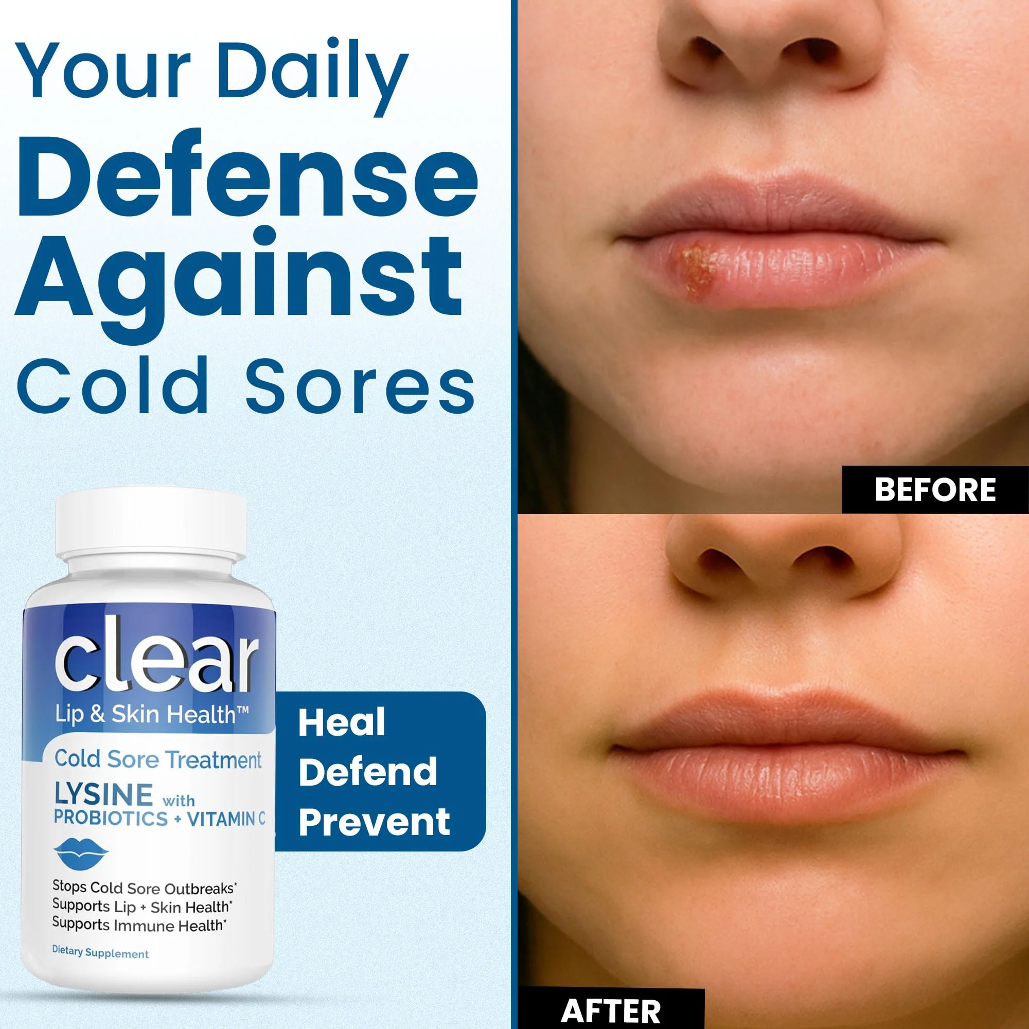 Clear Probiotics Lysine Cold Sore Treatment for Lips – Probiotic Lysine + Vitamin C – 180 Capsules - Image 12