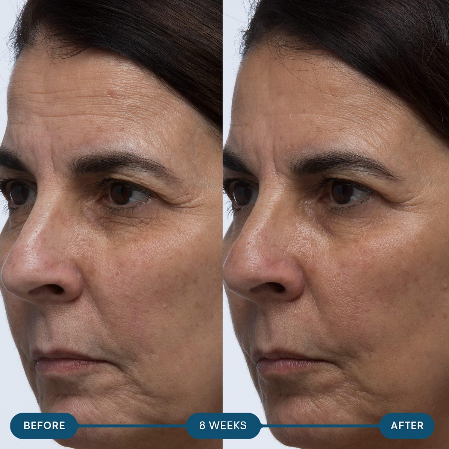 ELEMIS Pro-Collagen Skin Future Supplements — Daily Ingestible for Hydration, Elasticity & Fine Lines | 60 Capsules - Image 12
