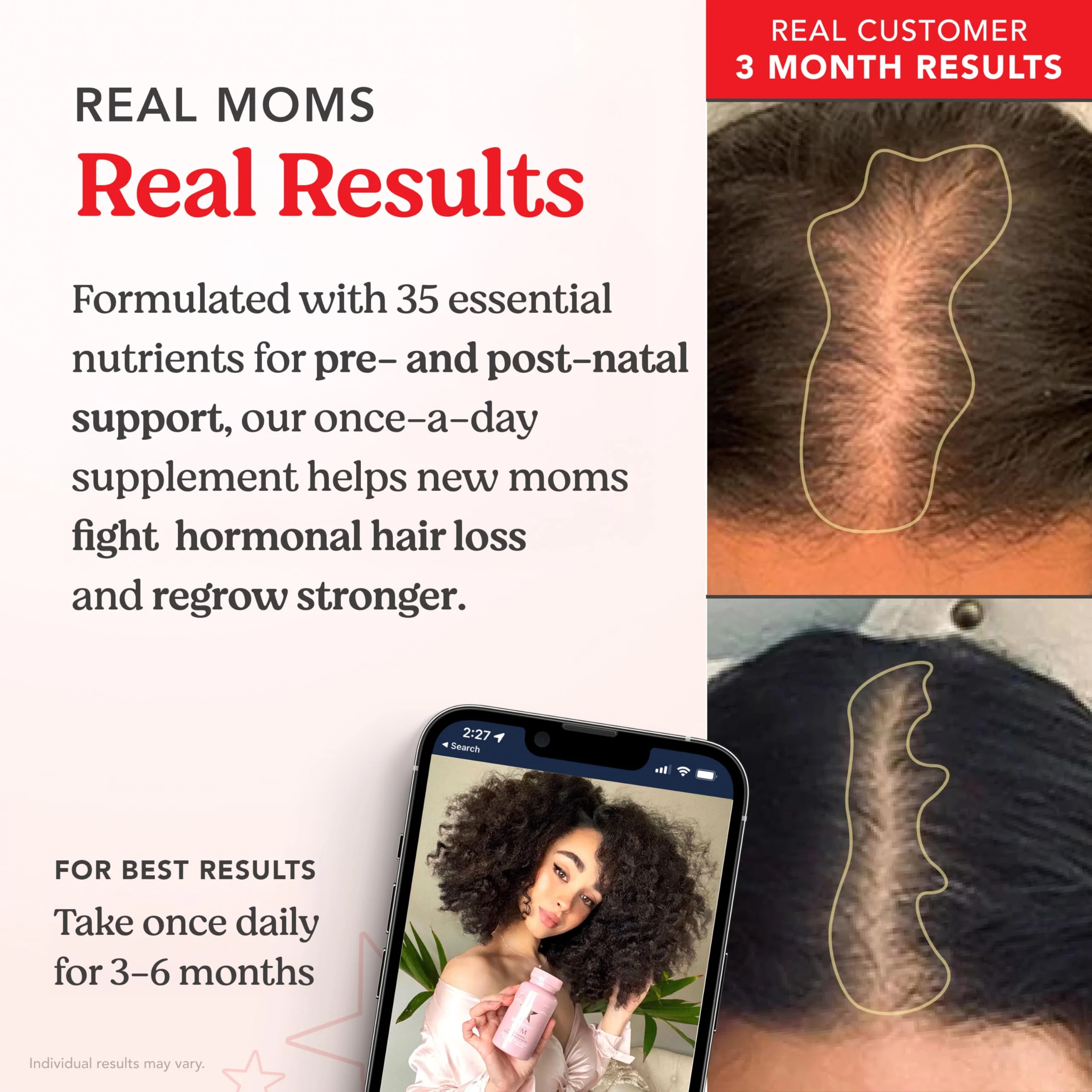 HAIRtamin MOM Vegan Prenatal & Postnatal Multivitamin – Hair, Nails & Skin Support | 3-Pack - Image 11