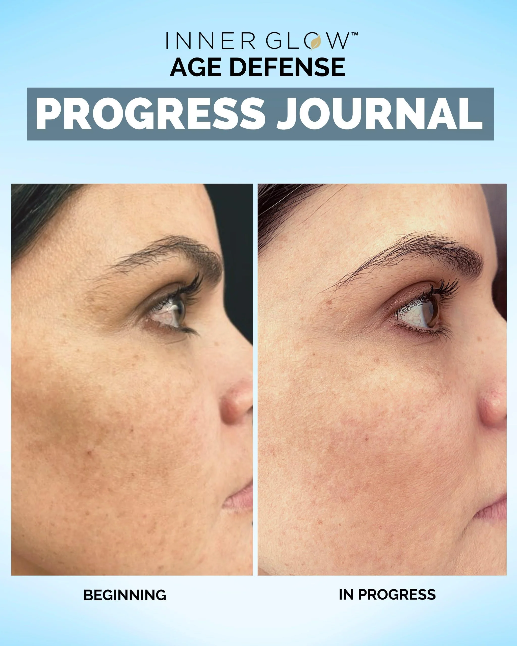 Inner Glow Age Defense Vitamins – Dermatologist & Plastic Surgeon Developed Antioxidant Formula for Photoaging and Melasma – Vegan, Gluten-Free – 60 Capsules - Image 20