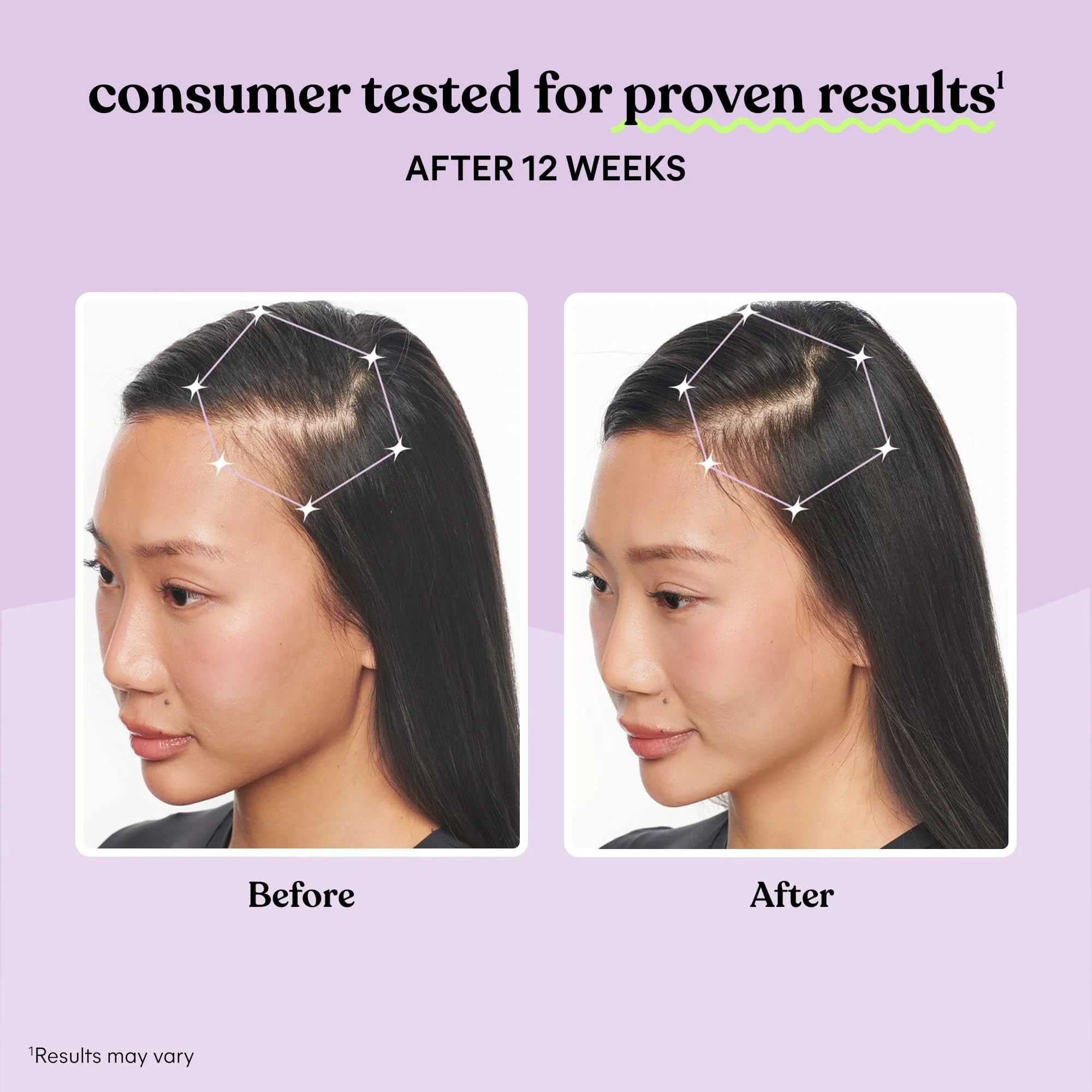 Lemme Grow Hair Supplement for Women | Keratin Complex for Thicker Hair - Image 10