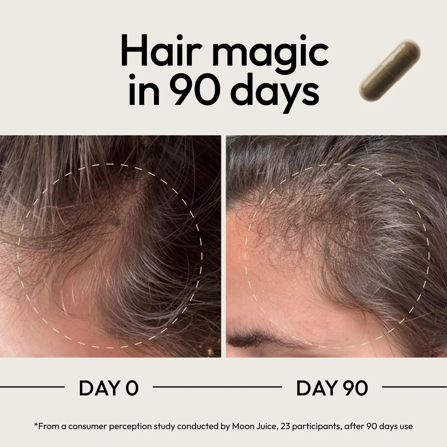 Moon Juice SuperHair Hair Growth Vitamins for Women & Men | Thicker, Healthier Hair - Image 4