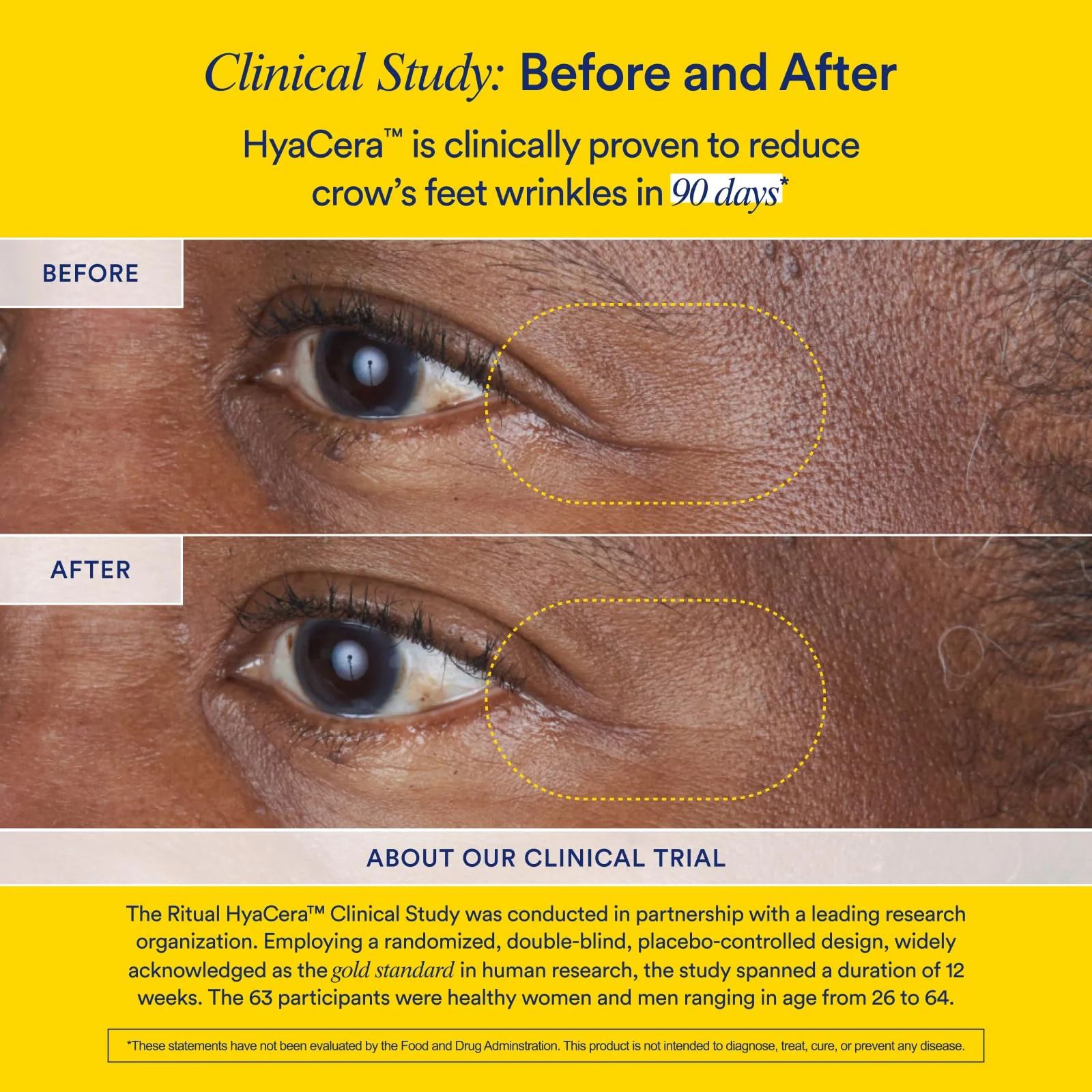 Ritual HyaCera Skin Supplement with Hyabest® & Ceratiq® – 30 Day Vanilla Formula - Image 13