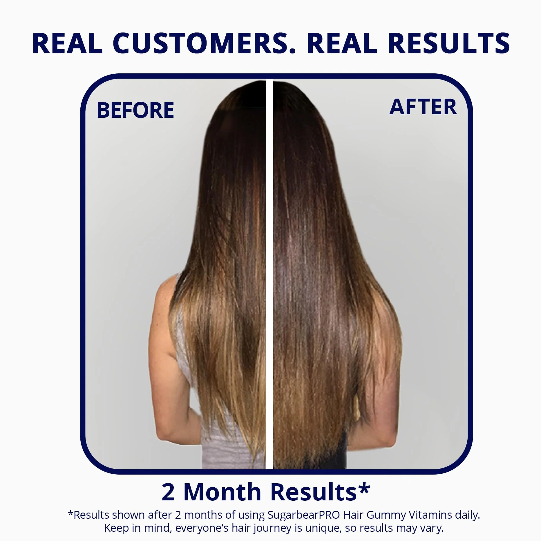 SugarBearPro Hair Vitamin Gummy – 3 Month, Extra Strength Biotin 6000mcg | Vegan, Kosher, Halal - Image 16
