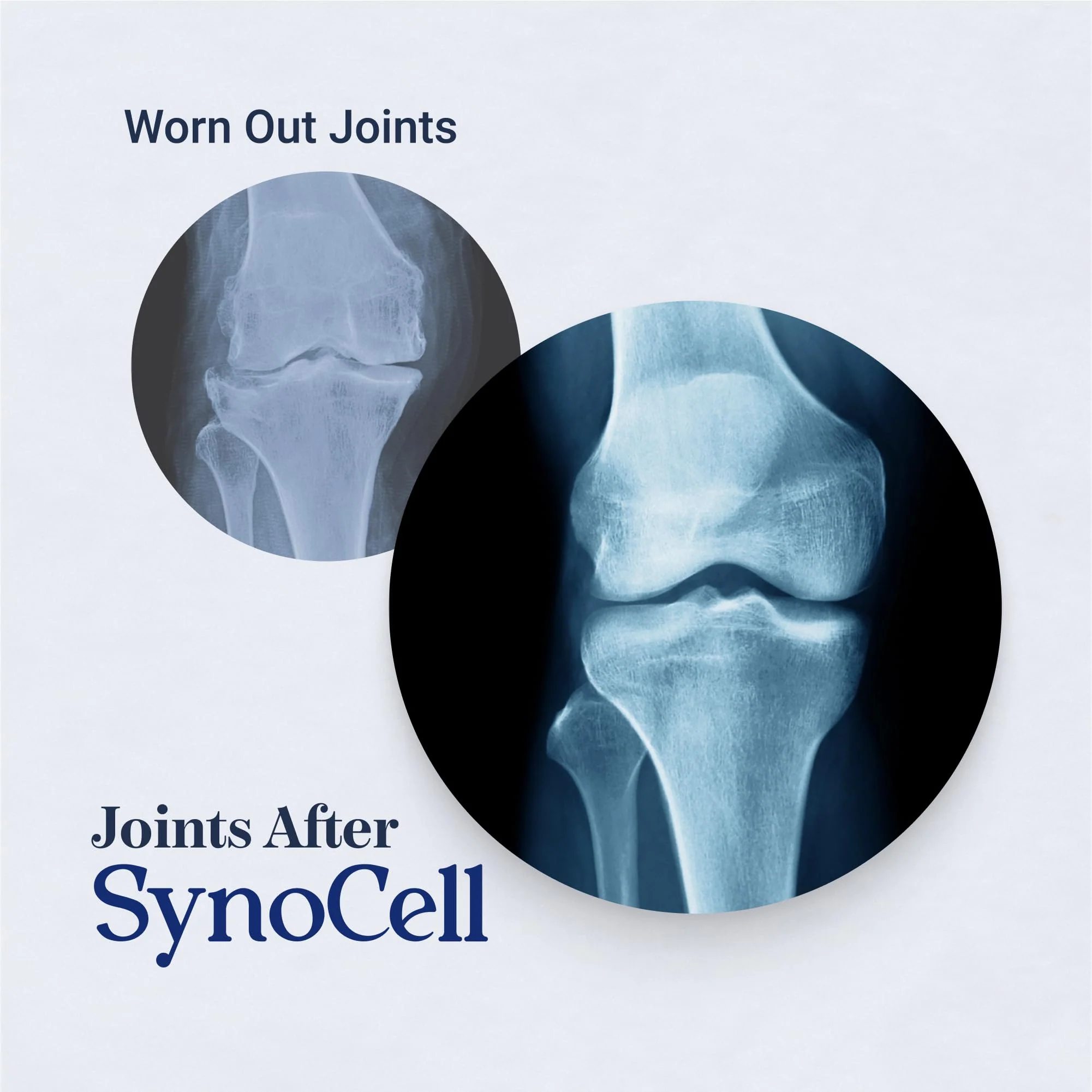 Synocell Glucosamine Chondroitin Complex 2-Pack – Joint Support with Boswellia, MSM - Image 17