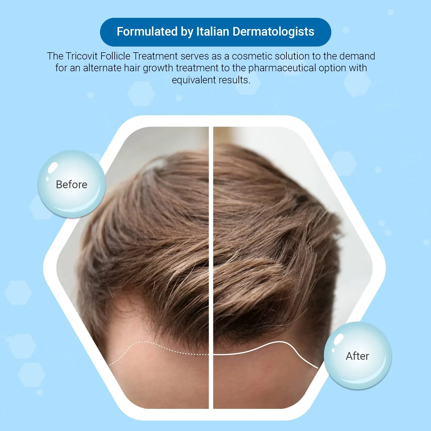 Tricovit Hair Growth Supplement | Nail & Hair Health Vitamins (60 tablets) - Image 10