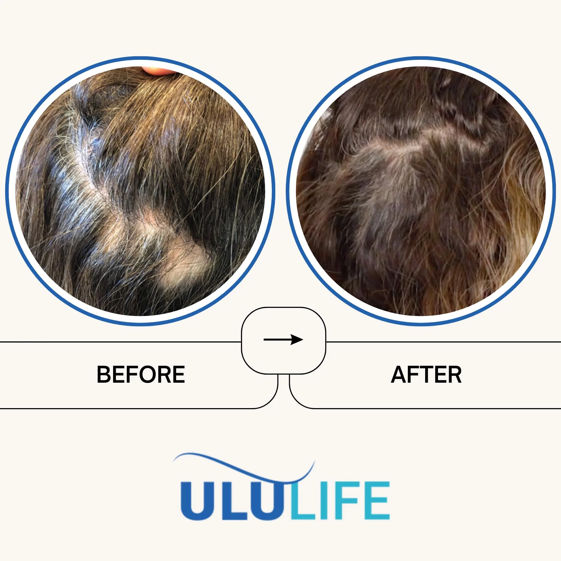 ULULIFE Ultimate Regrow Multivitamin – Hair Growth, Skin & Nails Health | 540 Capsules (90-Day Supply) - Image 3