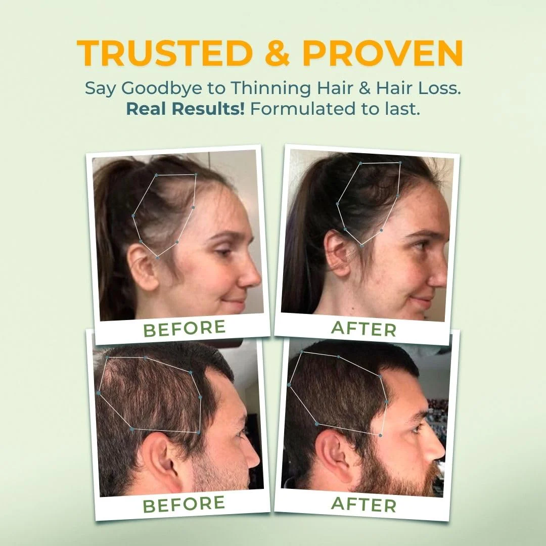 VITAL NUTRITIVE Vital Hair Complex – Biotin & Vitamin B Hair Vitamins for Women & Men (Hormone-Free, Gluten-Free) - Image 7